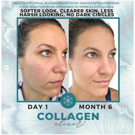 poliquin supplements|collagen supplements before and after.